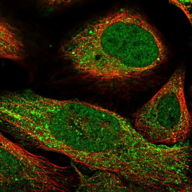 Immunofluorescent staining of human cell line U-2 OS shows localization to nucleoplasm & cytosol.